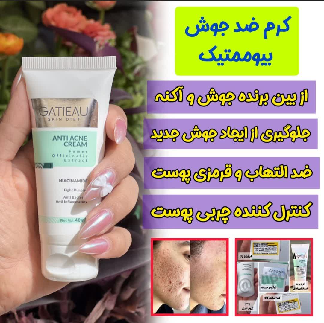 پک دو محصوله رفع لک و اکنه و جوش و رفع منافذ ژل انتی اکنه گاتیو --- ژل شست و شو ویتابلا